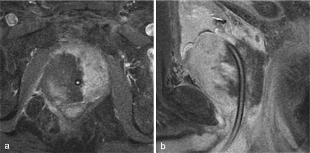 Fig. 26