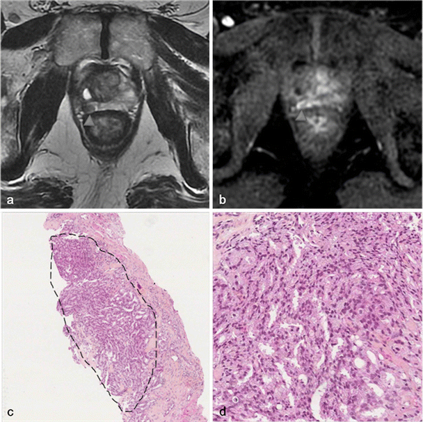 Fig. 28