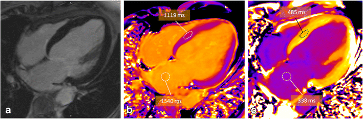 Fig. 10