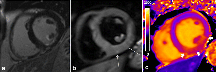 Fig. 11