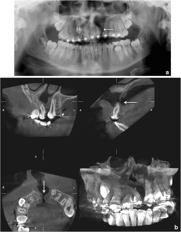 Fig. 12