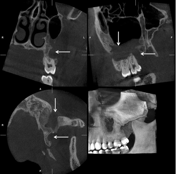 Fig. 13