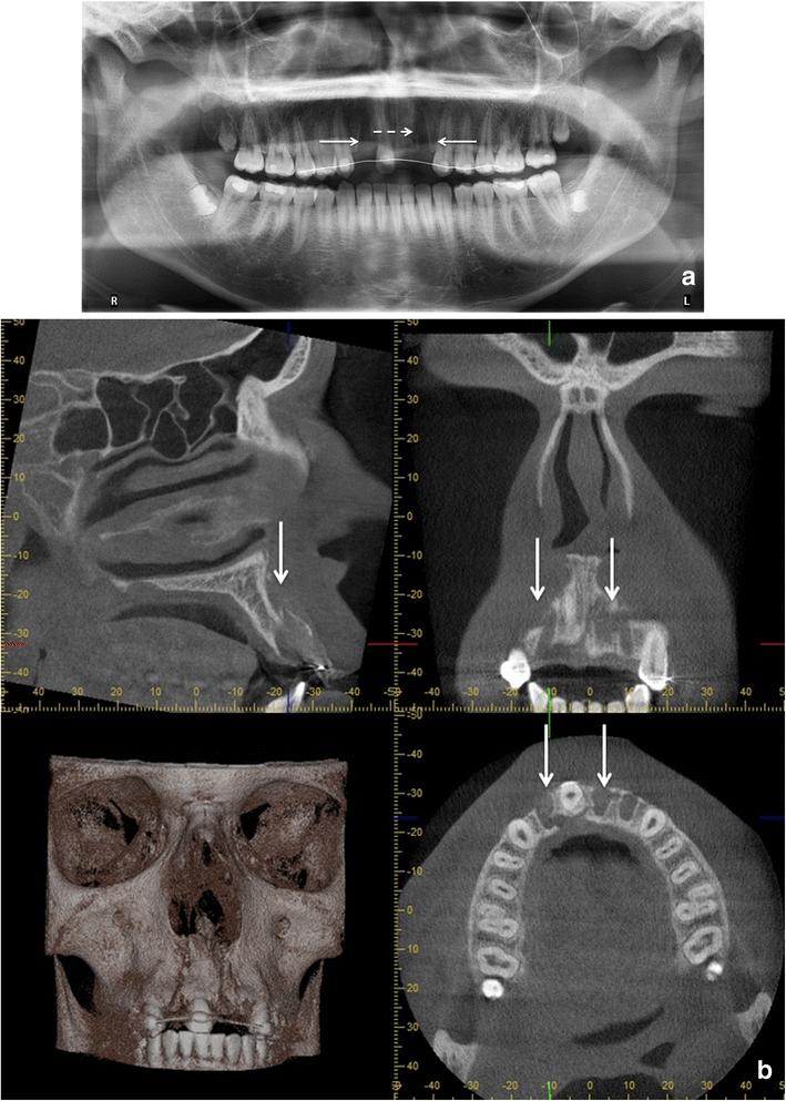 Fig. 15