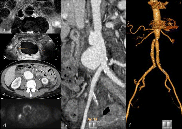 Fig. 10