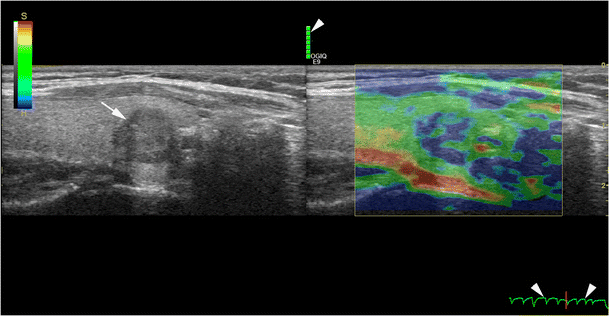 Fig. 10