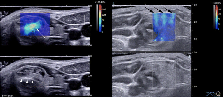 Fig. 15