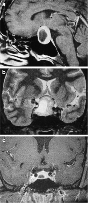 Fig. 19