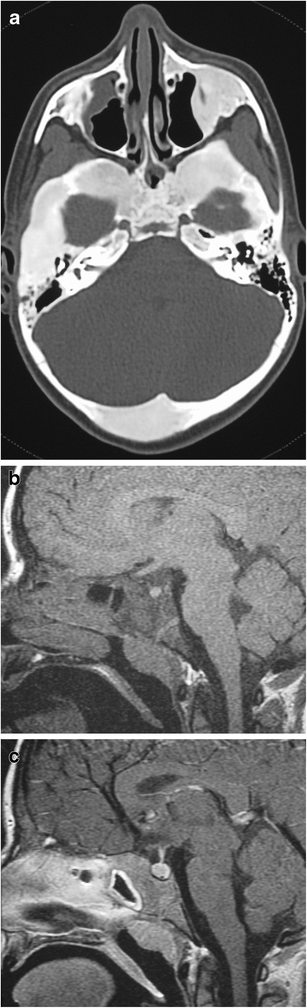 Fig. 27