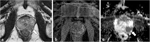 Fig. 11