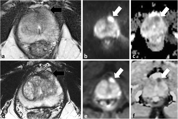 Fig. 12