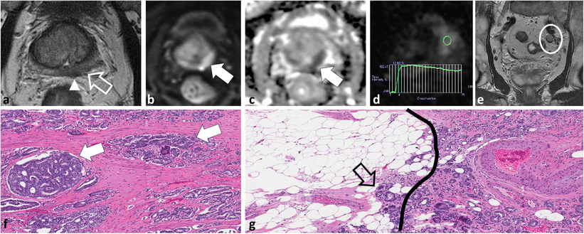 Fig. 15