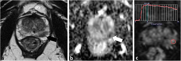 Fig. 16