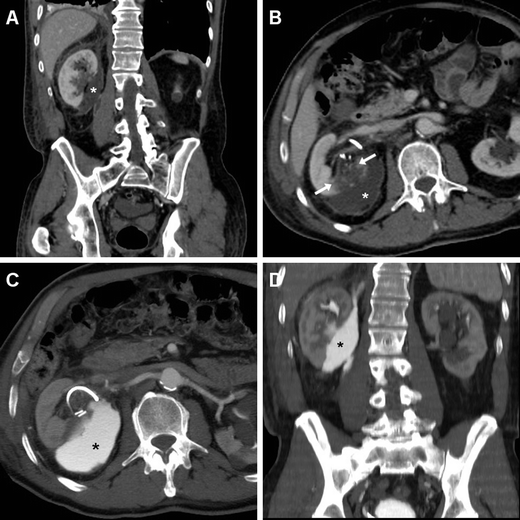 Fig. 11