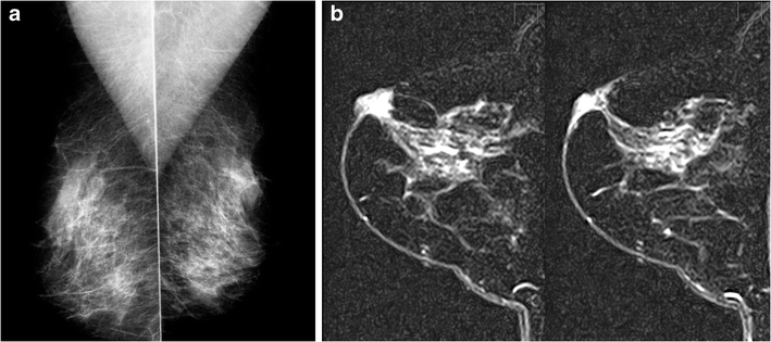 Fig. 11