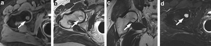 Fig. 12