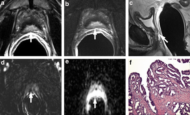 Fig. 20