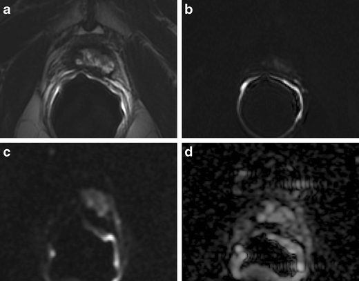 Fig. 22