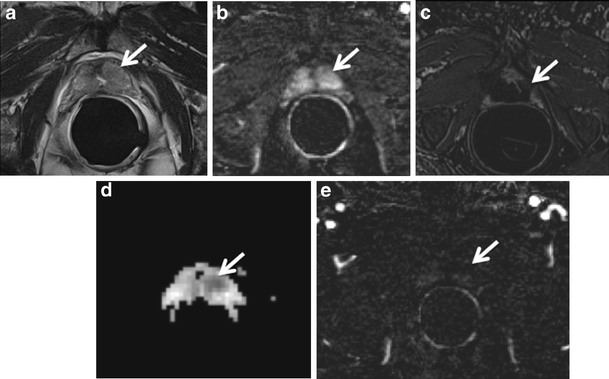 Fig. 23