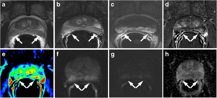 Fig. 25