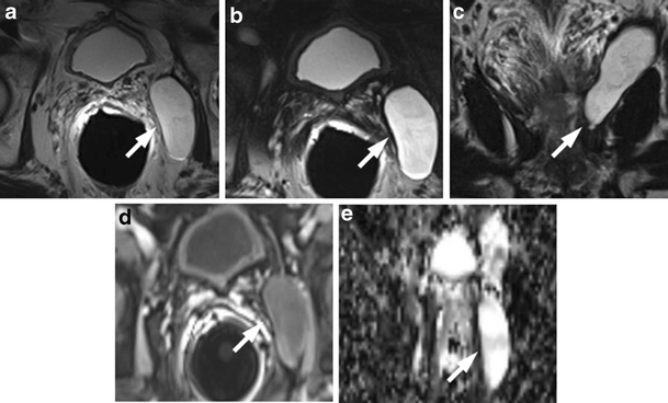 Fig. 26