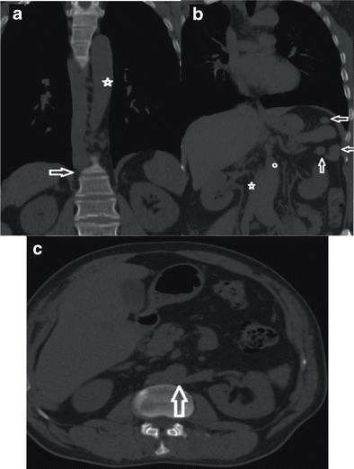 Fig. 11