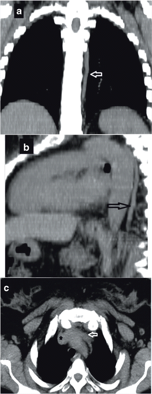 Fig. 14