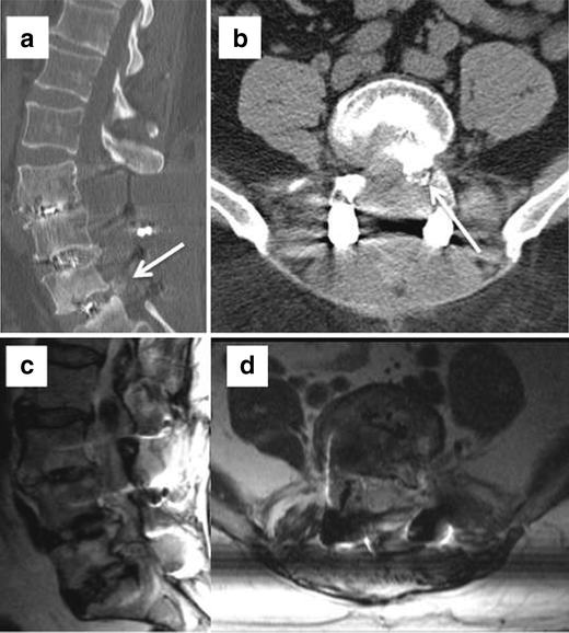 Fig. 11