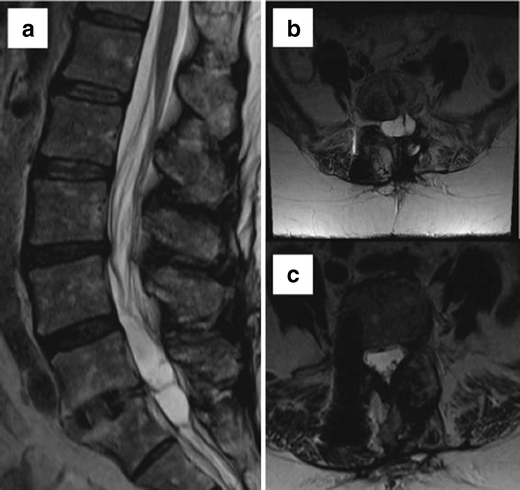 Fig. 13