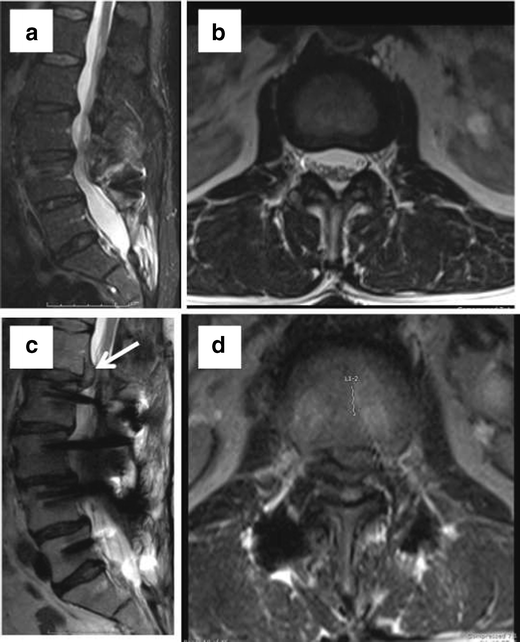 Fig. 14