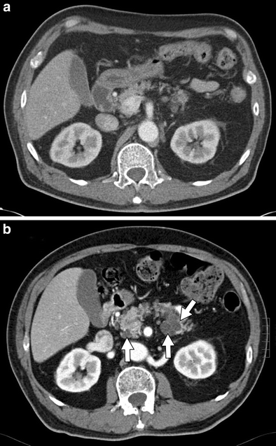 Fig. 10