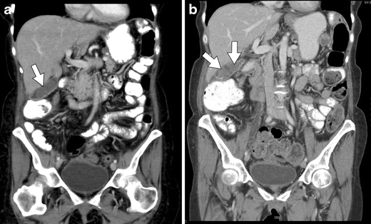 Fig. 14