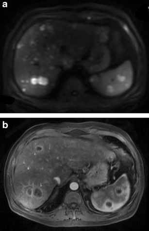 Fig. 11