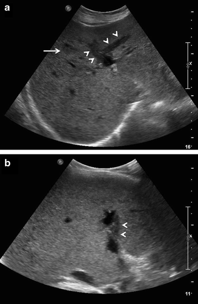 Fig. 14