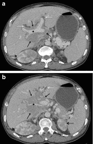 Fig. 15