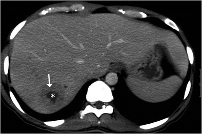 Fig. 12