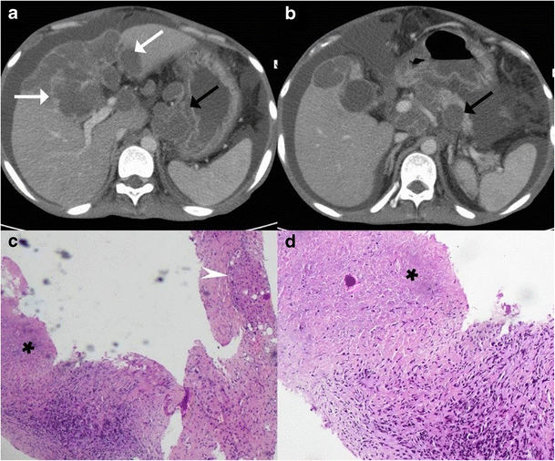 Fig. 16