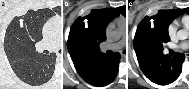 Fig. 13