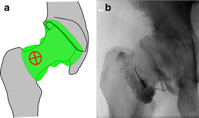 Fig. 12