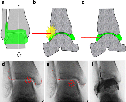 Fig. 15