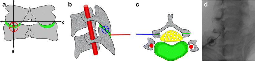 Fig. 16