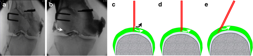 Fig. 18