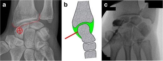 Fig. 7