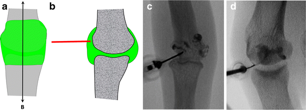 Fig. 9