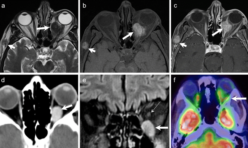 Fig. 21