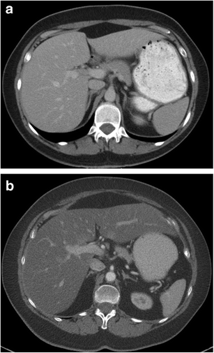 Fig. 11