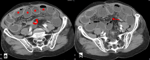 Fig. 11