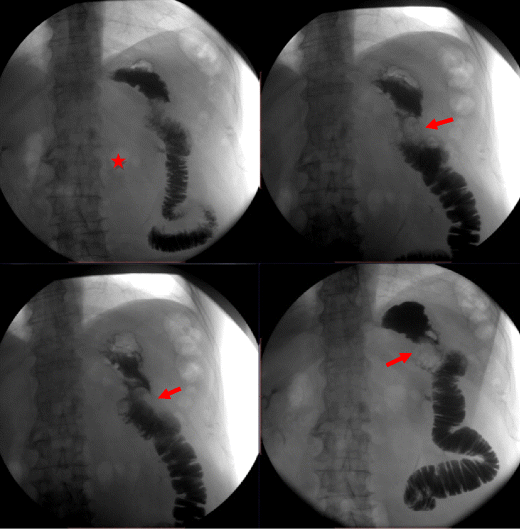 Fig. 13