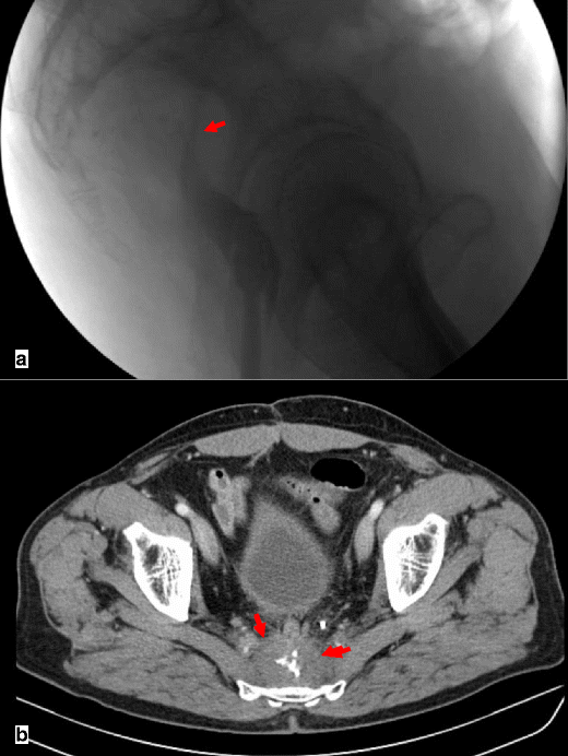 Fig. 17