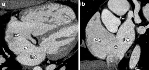 Fig. 11