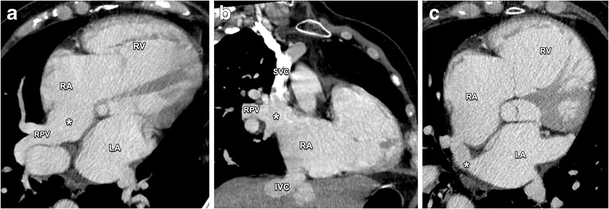 Fig. 14